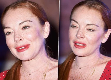 Lindsay Lohan xuất hiện với gương mặt khác lạ giữa tin đồn thẩm mỹ