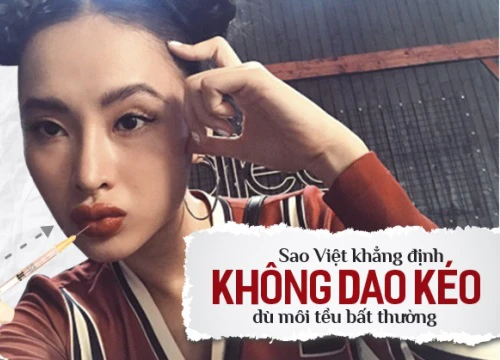 Rõ ràng là môi tều thế kia mà sao Việt nào cũng "chối đây đẩy" khi dính nghi vấn đụng chạm dao kéo