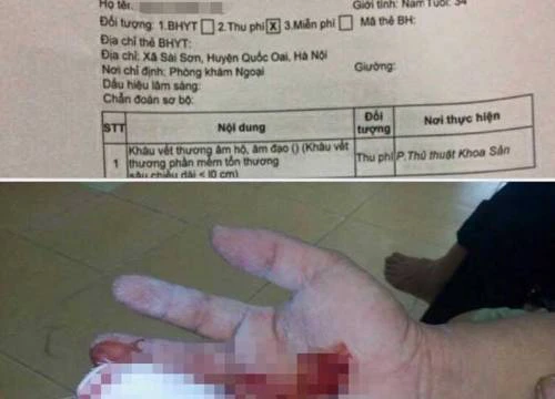Thông tin mới vụ bệnh nhân nam được chỉ định &#8220;khâu âm hộ&#8221;