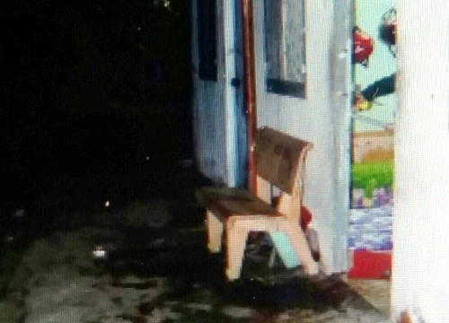 Từ chối bán hàng, người đàn ông bị chém đứt gân