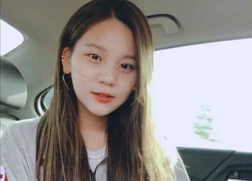 "Nữ thần tượng xấu nhất lịch sử Kpop" Umji gây xôn xao vì nhan sắc "thăng cấp" bất ngờ