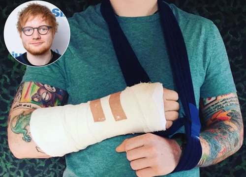 Ed Sheeran hủy show ở châu Á vì gãy tay