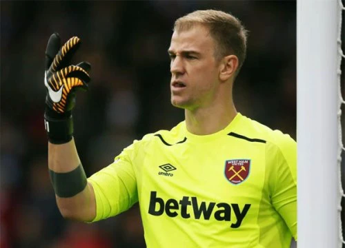 Thủ môn Joe Hart bị cướp 'quây' trên đường về nhà