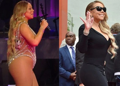 Mariah Carey bụng to đùi mỡ bỗng thon gọn thần kỳ nhờ phẫu thuật cắt vạt dạ dày