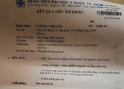 Thẩm phán bị tố đạp vào đùi đương sự