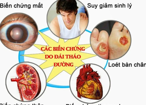 Bác sĩ BV Bạch Mai chỉ ra những sai lầm người đái tháo đường hay mắc phải