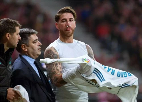 Sergio Ramos bị vỡ mũi vẫn thi đấu