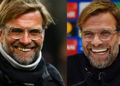 Klopp điệu đà khi sử dụng dịch vụ làm trắng răng