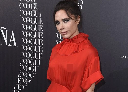 Đã hớ hênh nhũ hoa, Victoria Beckham còn không ngại khoe đôi chân mẩn đỏ vì muỗi cắn