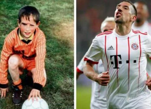 Ribery: Câu chuyện đau lòng phía sau những vết sẹo đáng sợ