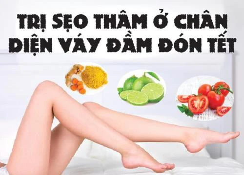 Cách trị sẹo thâm ở chân bằng nguyên liệu từ thiên nhiên!