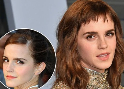 Emma Watson gây tiếc nuối vì nhan sắc xuống dốc không phanh tại tiệc hậu Oscar 2018