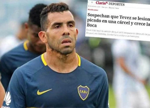 Tevez chấn thương khi thi đấu trong... tù