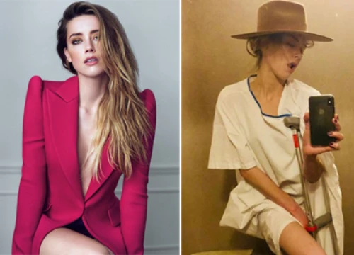 Amber Heard bị gẫy xương vẫn tranh thủ selfie trong bệnh viện