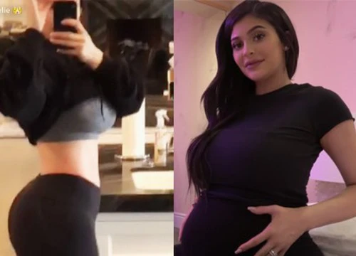 2 tháng sau sinh, Kylie Jenner gây ngỡ ngàng với vùng bụng phẳng lỳ nhờ giảm 15 kg