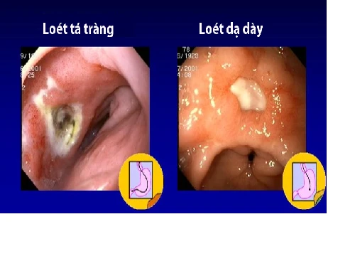 Nhận biết một số tác hại của thuốc