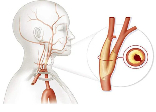 Không ngờ 10 loại thực phẩm phổ biến này có công dụng loại bỏ tạp chất trong máu