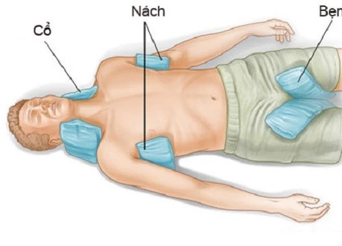 Xứ trí khi có người bị sốc nhiệt ngày nghỉ lễ