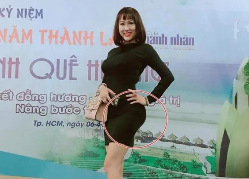 Sau ca đại phẫu toàn thân, Phi Thanh Vân xuất hiện với vòng 3 biến dạng