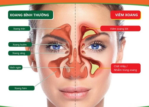 5 bệnh không nên dùng kháng sinh, toàn những bệnh phổ biến mà hầu như ai cũng gặp