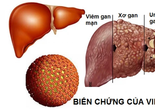 Chuyên gia chỉ ra 9 cách tự giải độc mỗi khi gan phải 'làm việc quá sức'