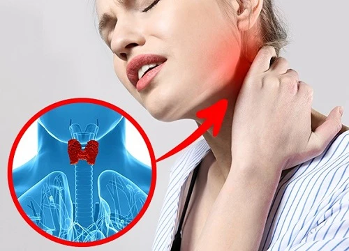 Các triệu chứng của bệnh lý tuyến giáp bạn không được bỏ qua