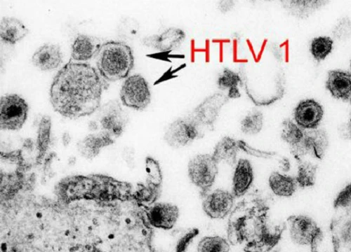 Virus cổ xưa có 'họ hàng với HIV' đột nhiên trỗi dậy