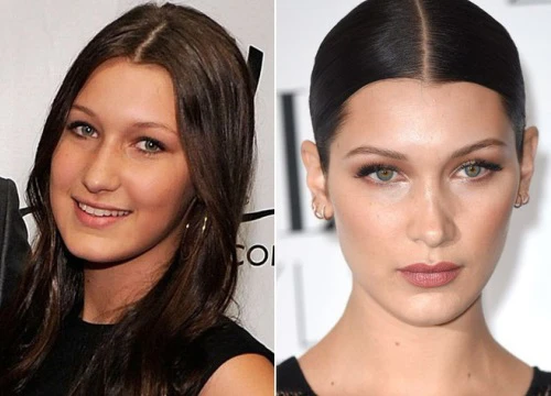 Nhan sắc thay đổi rõ rệt, Bella Hadid gây tranh cãi vì vẫn chối không "đập mặt xây lại"