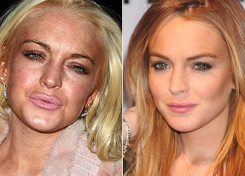 Lindsay Lohan tuổi 32: Nhan sắc già nhăn nheo trước tuổi, phải &#8220;chạy trốn&#8221; khỏi Hollywood