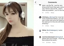 Bị tố "dao kéo" khiến mặt đơ cứng, Park Bom van xin netizen để yên và cuối cùng cũng lên tiếng về tin đồn