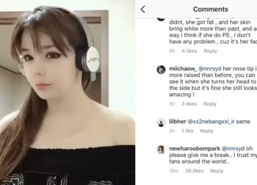 Bị tố "dao kéo" khiến mặt đơ cứng, Park Bom van xin netizen để yên và cuối cùng cũng lên tiếng về tin đồn