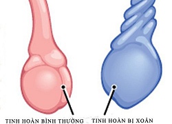 Hai bé trai bỗng bị hoại tử tinh hoàn