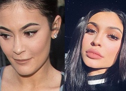 "Nữ hoàng môi tều" Kylie Jenner gây xôn xao vì đôi môi mỏng dính khó nhận ra sau khi rút flller