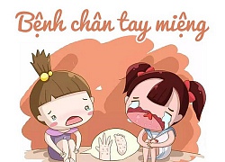 Căn bệnh nguy hiểm thời điểm giao mùa: Bệnh chân tay miệng