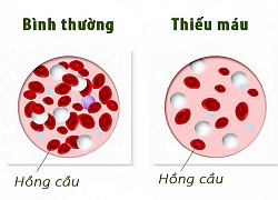 Đậu tương vị thuốc chữa nhiều bệnh