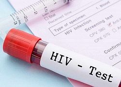 Quy trình xét nghiệm khẳng định nhiễm HIV thế nào?