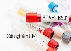 Xét nghiệm HIV miễn phí cho dân ở xã có 42 người nhiễm bệnh