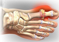 'Chê' bác sĩ chẩn đoán sai bệnh, một phụ nữ bị nguy kịch