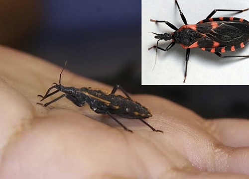 300.000 người Mỹ mắc căn bệnh nguy hiểm mang tên 'Chagas'