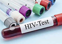 Tầm soát thế nào khi nghi ngờ nhiễm HIV