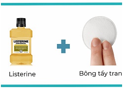 Bật mí mẹo trị gàu đơn giản mà hiệu quả với nước súc miệng listerine