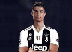 Sau khi tập luyện với mắt tím bầm, Ronaldo ra yêu cầu cực gắt với Juventus