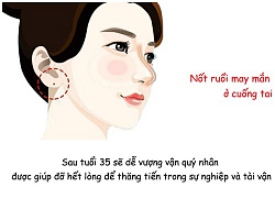 5 nốt ruồi vượng vận đào hoa giúp nam nữ giàu sang, phú quý song toàn