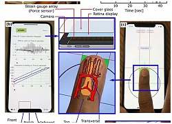 Các nhà nghiên cứu phát triển ứng dụng đo huyết áp cho iPhone, không cần cảm biến như của Galaxy S9