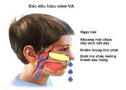 Viêm VA - Bệnh thường gặp ở trẻ em