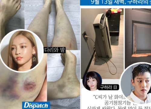 Dispatch bóc mẽ vụ hành hung chấn động: Goo Hara bị chảy máu tử cung, âm đạo, bầm tím cả người vì bạn trai đánh