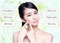 Mụn ư? Đừng lo lắng vì bạn có thể thổi bay chúng nhanh chóng với cách này