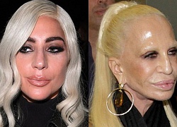 Mặt cứng đơ kém sắc, Lady Gaga bị nghi lạm dụng thẩm mỹ giống "thảm họa dao kéo" Donatella Versace