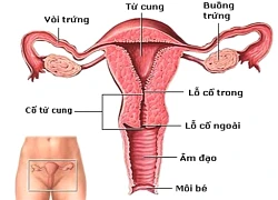 8 câu hỏi giúp phát hiện sớm bệnh ở cổ tử cung