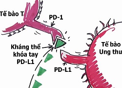 Bác sĩ Việt Nam: 'Liệu pháp miễn dịch là tiến bộ đột phá trong chữa ung thư'